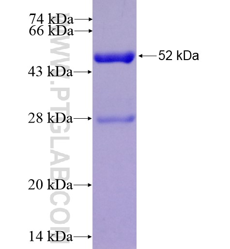 ACAD10 fusion protein Ag10529 SDS-PAGE ACAD10 fusion protein Ag10529 SDS-PAGE