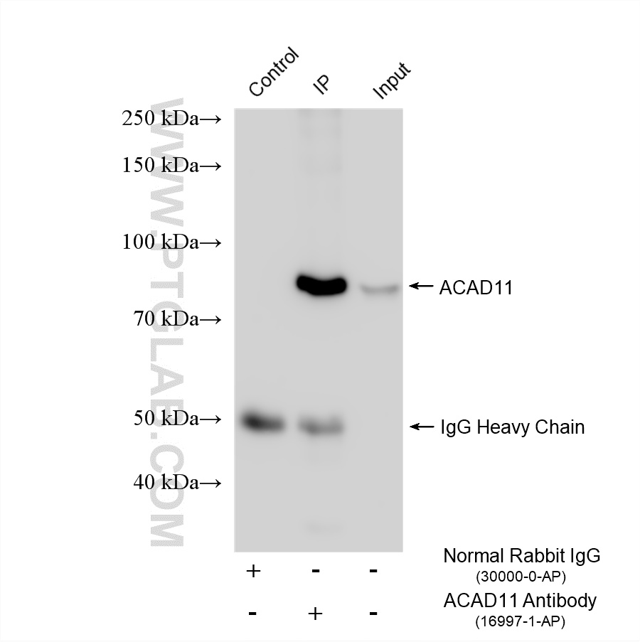 IP experiment of mouse kidney using 16997-1-AP