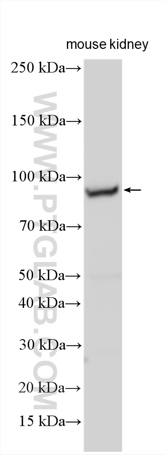 WB analysis using 16997-1-AP