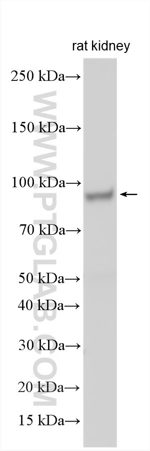 WB analysis using 16997-1-AP