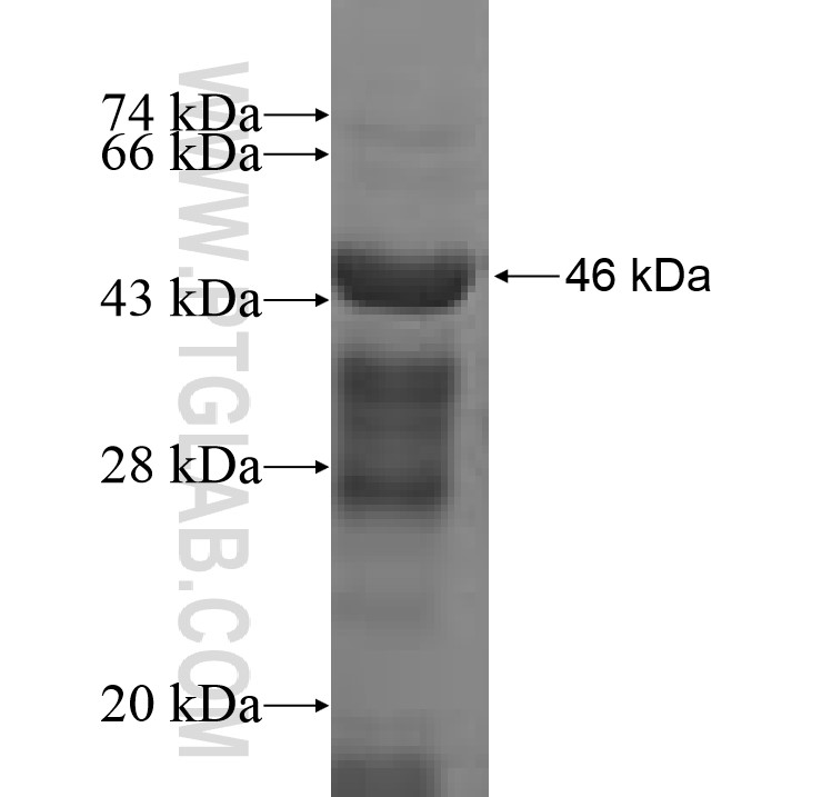 ACAD8 fusion protein Ag9967 SDS-PAGE