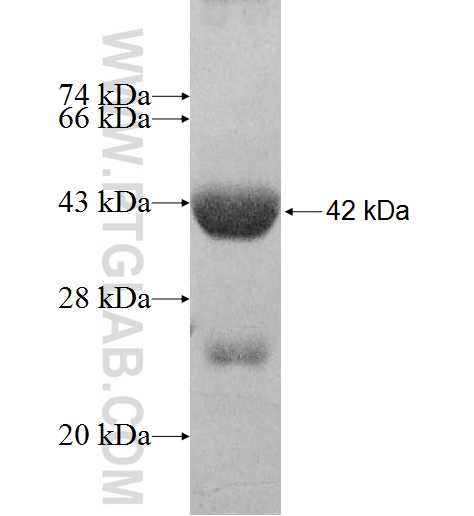 ACAD9 fusion protein Ag8414 SDS-PAGE