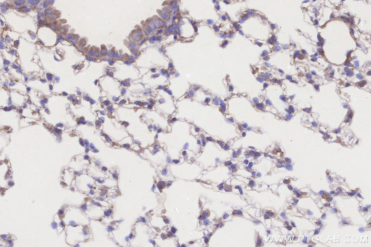 IHC staining of mouse lung using 17442-1-AP IHC staining of mouse lung using 17442-1-AP