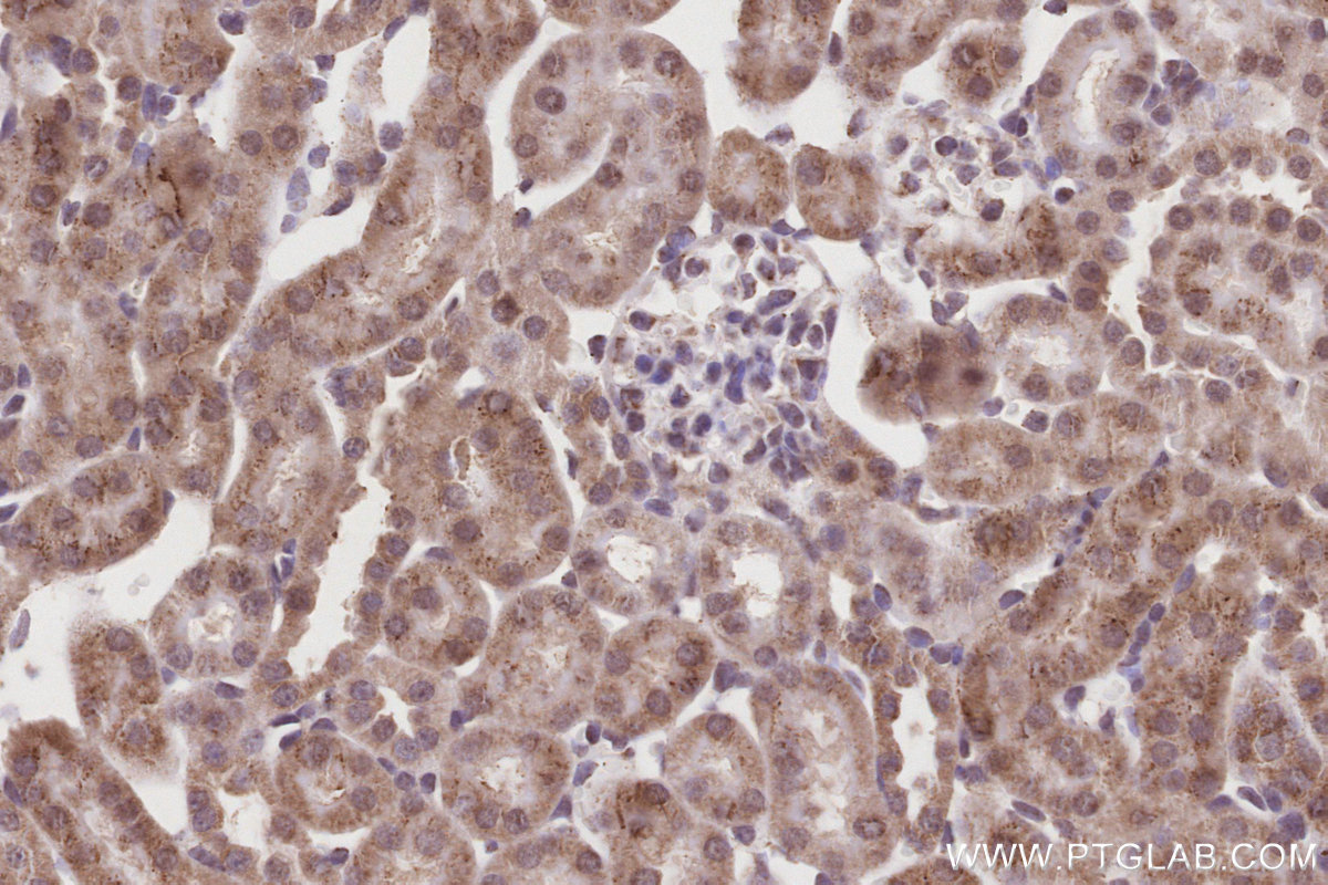 IHC staining of mouse kidney using 17526-1-AP IHC staining of mouse kidney using 17526-1-AP