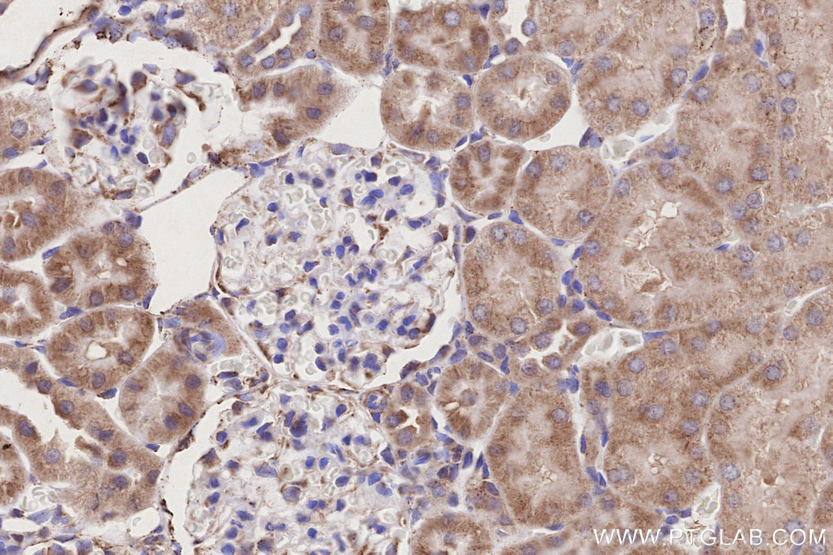 IHC staining of rat kidney using 17526-1-AP IHC staining of rat kidney using 17526-1-AP