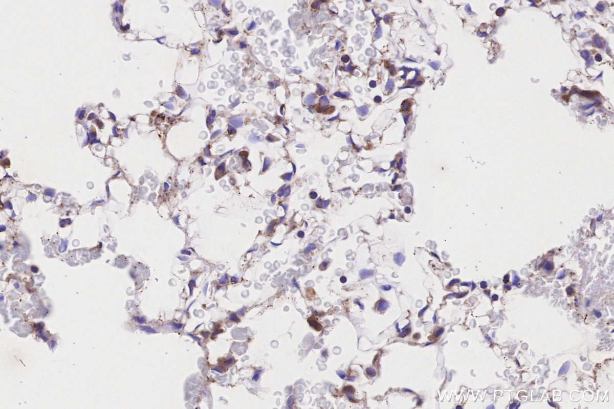 IHC staining of rat lung using 17526-1-AP IHC staining of rat lung using 17526-1-AP