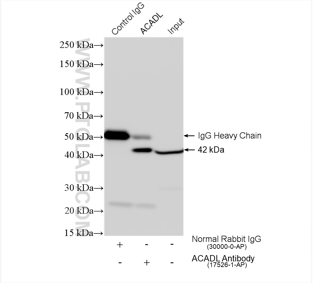 IP experiment of mouse kidney using 17526-1-AP