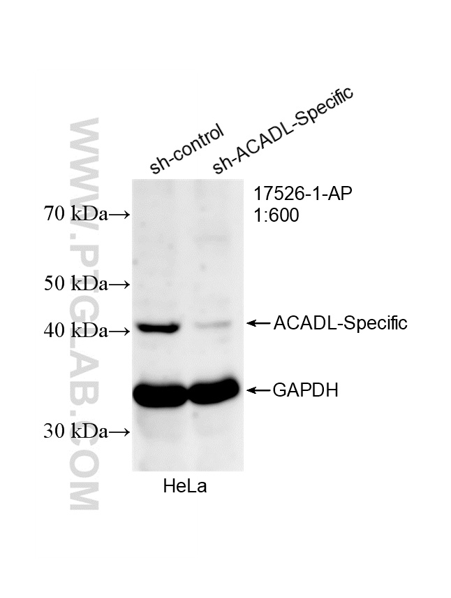 WB analysis of HeLa using 17526-1-AP WB analysis of HeLa using 17526-1-AP