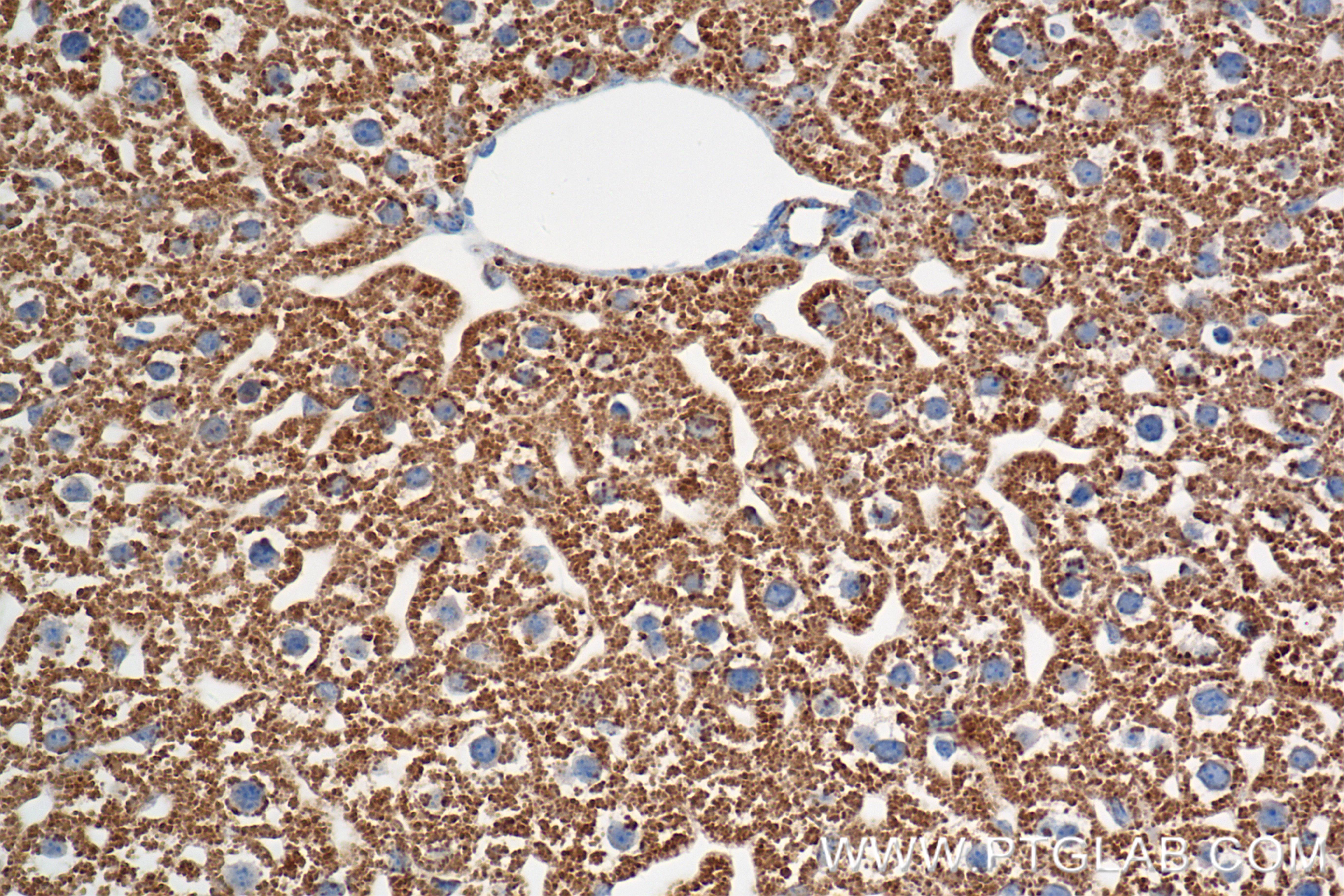 IHC staining of mouse liver using 85379-1-RR