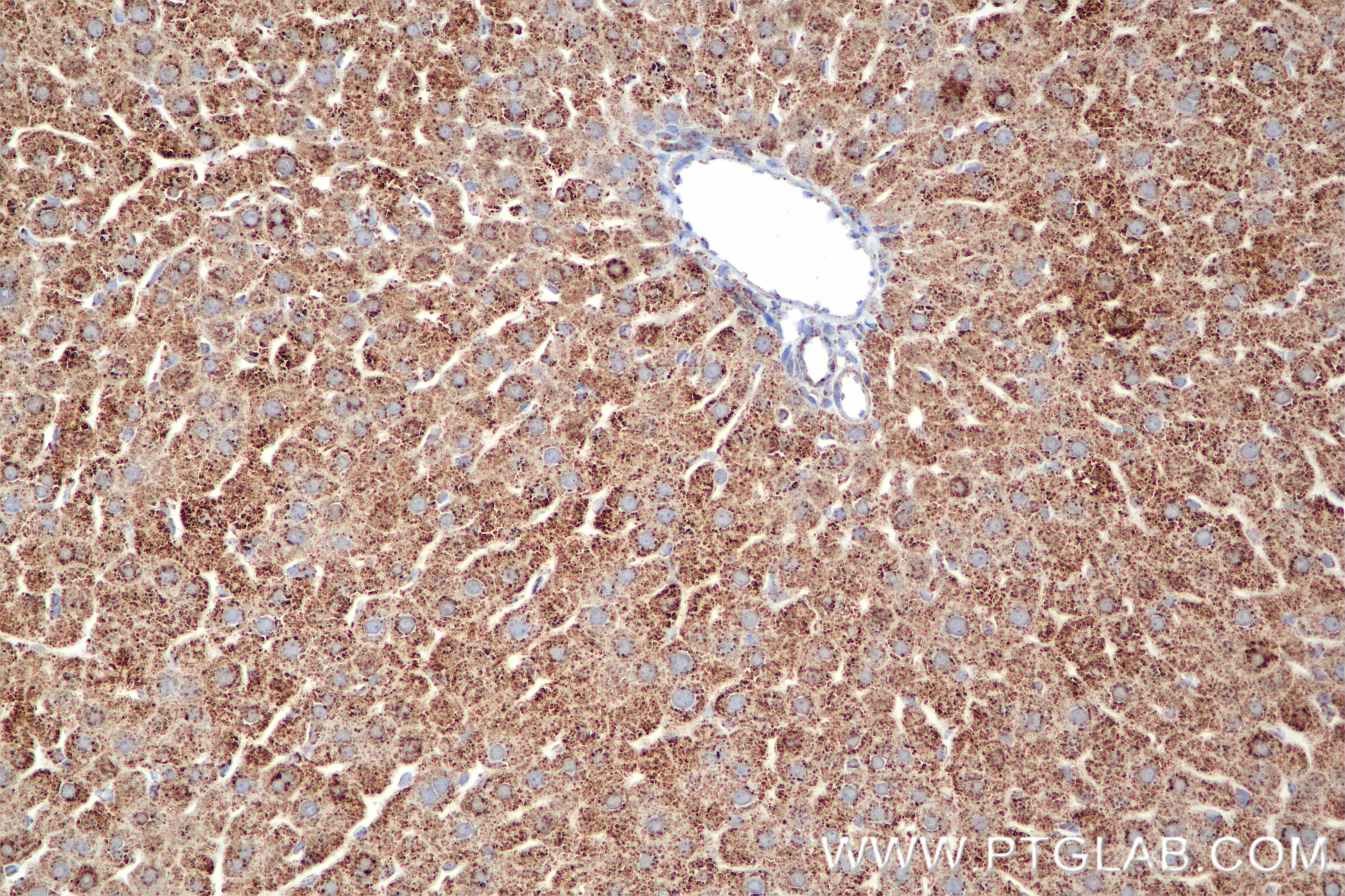 IHC staining of rat liver using 85379-1-RR
