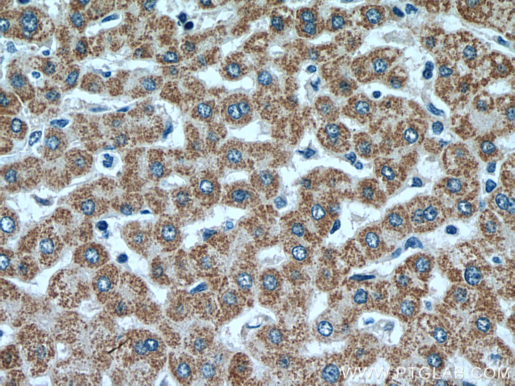 IHC staining of human liver using 67742-1-Ig