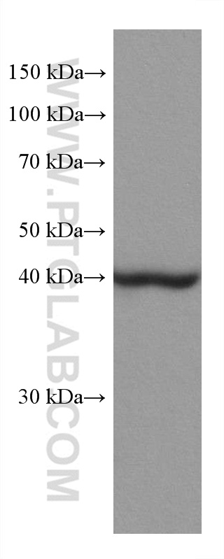 WB analysis of rat liver using 67742-1-Ig