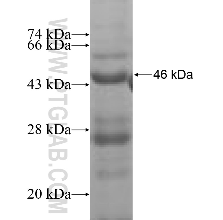 ACADM fusion protein Ag8682 SDS-PAGE ACADM fusion protein Ag8682 SDS-PAGE