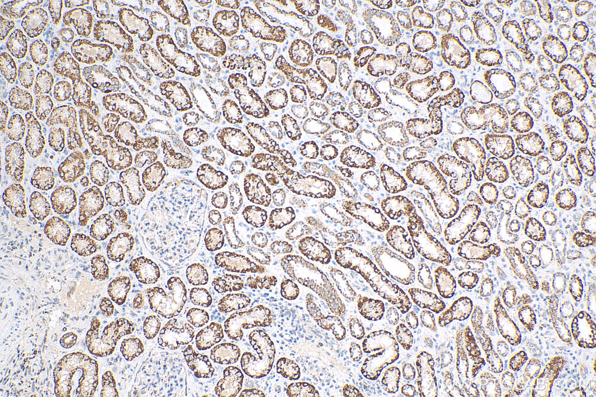 IHC staining of human kidney using 16623-1-AP