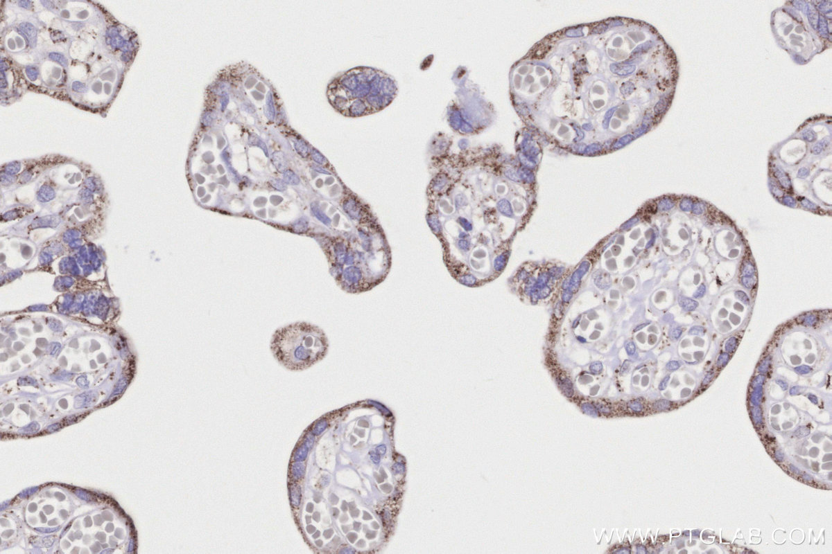 IHC staining of human placenta using 16623-1-AP IHC staining of human placenta using 16623-1-AP