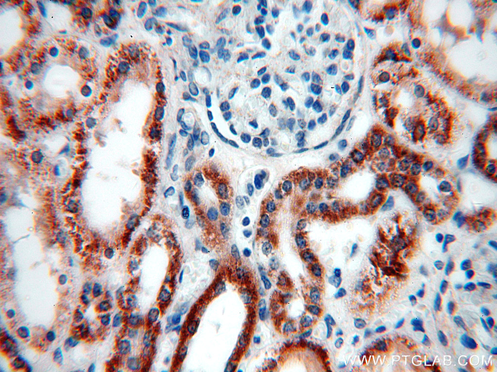 IHC staining of human kidney using 16623-1-AP