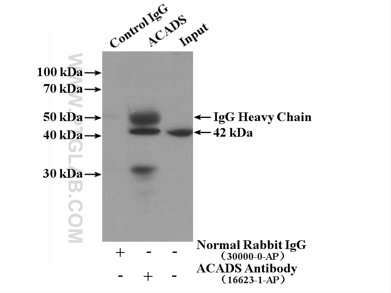 IP experiment of HEK-293 using 16623-1-AP