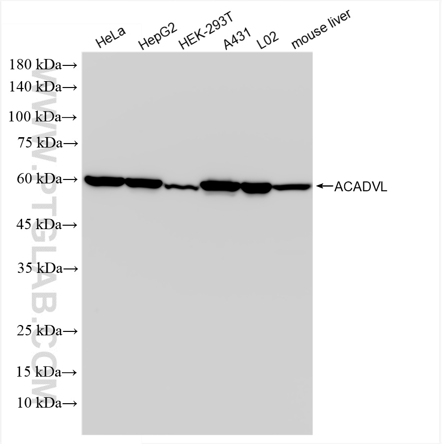 WB analysis using 85889-1-RR