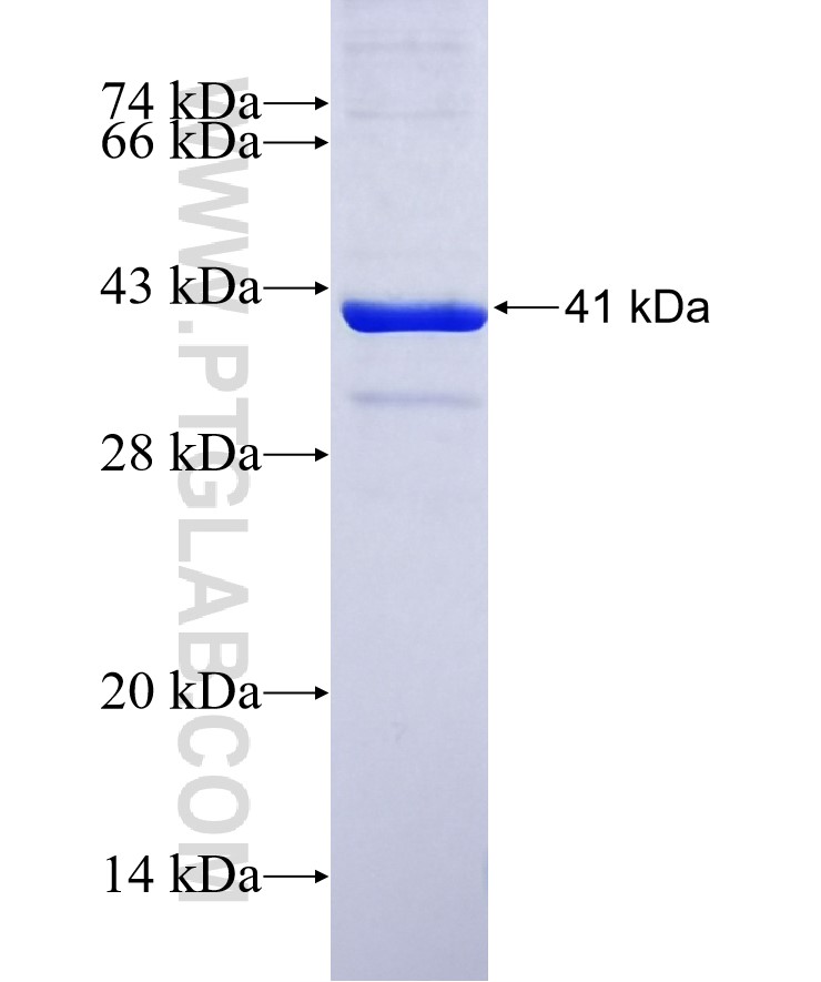 ACADVL fusion protein Ag6016 SDS-PAGE