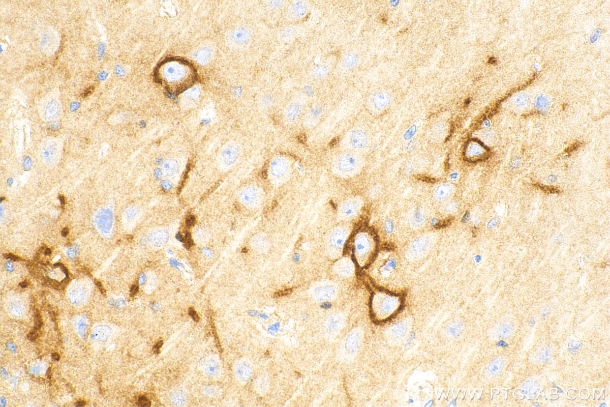 IHC staining of rat brain using 13880-1-AP
