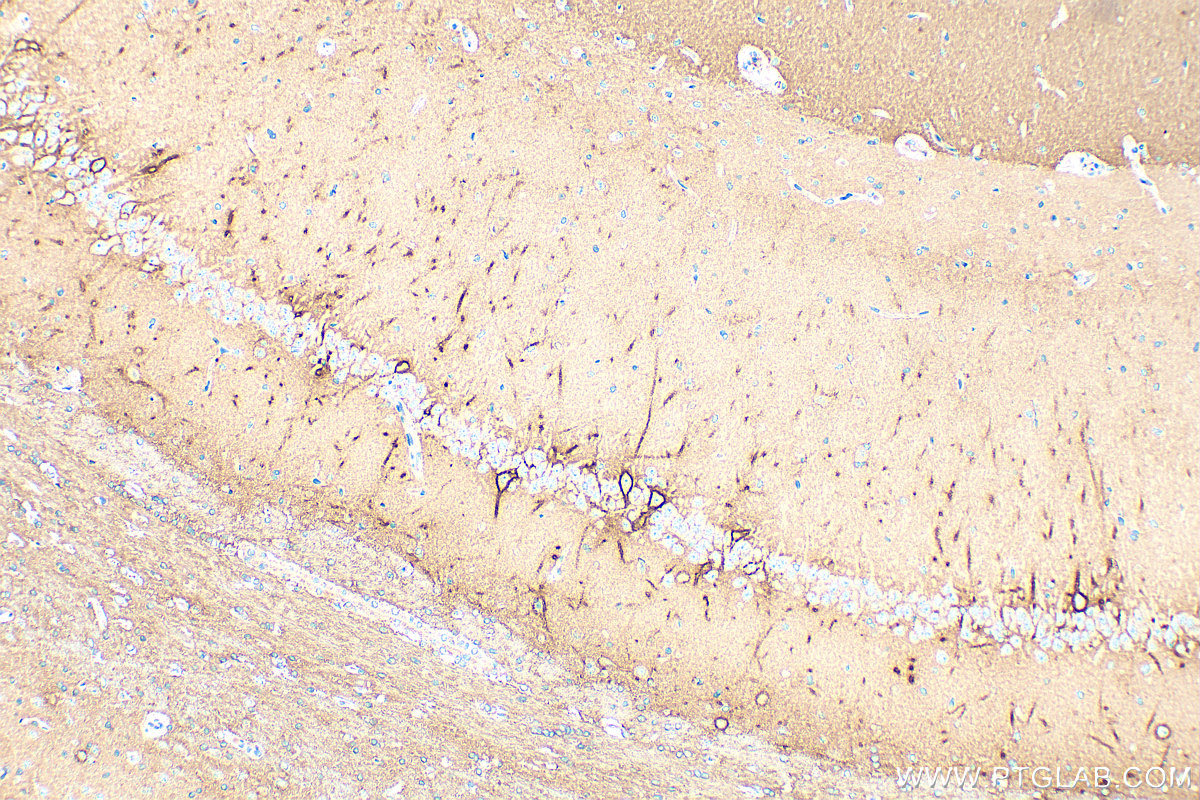 Immunohistochemical analysis of paraffin-embedded rat brain tissue slide using 13880-1-AP (Aggrecan antibody) at dilution of 1:2000 (under 10x lens). Heat mediated antigen retrieval with Tris-EDTA buffer (pH 9.0). IHC staining of rat brain using 13880-1-AP