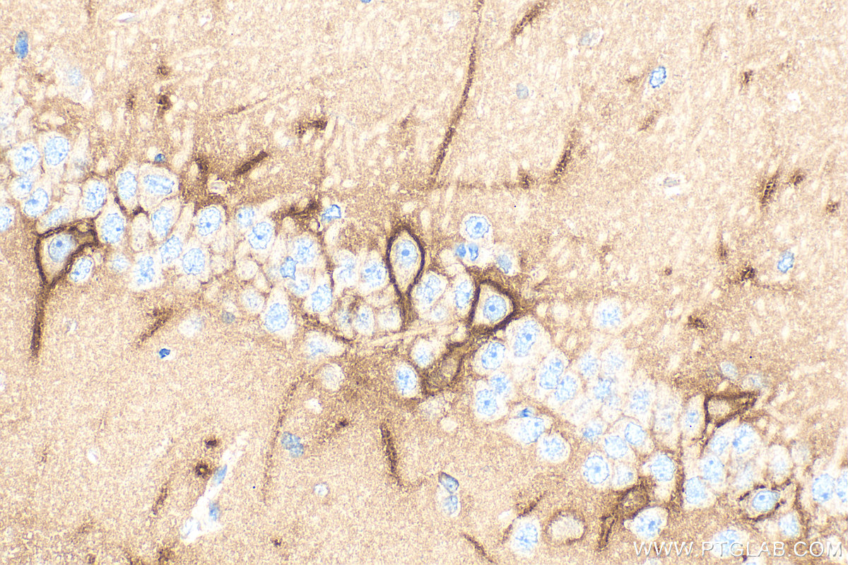 Immunohistochemical analysis of paraffin-embedded rat brain tissue slide using 13880-1-AP (Aggrecan antibody) at dilution of 1:2000 (under 40x lens). Heat mediated antigen retrieval with Tris-EDTA buffer (pH 9.0). IHC staining of rat brain using 13880-1-AP