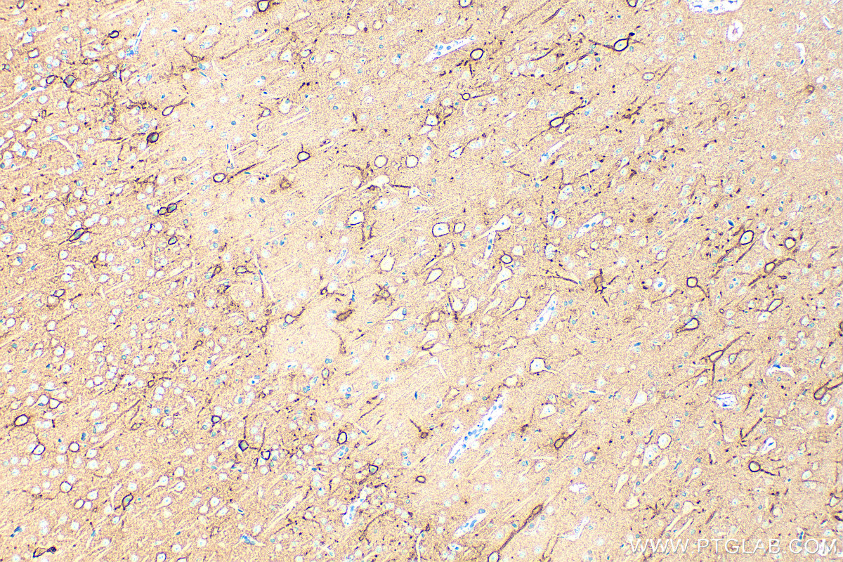Immunohistochemical analysis of paraffin-embedded rat brain tissue slide using 13880-1-AP (Aggrecan antibody) at dilution of 1:2000 (under 10x lens). Heat mediated antigen retrieval with Tris-EDTA buffer (pH 9.0). IHC staining of rat brain using 13880-1-AP
