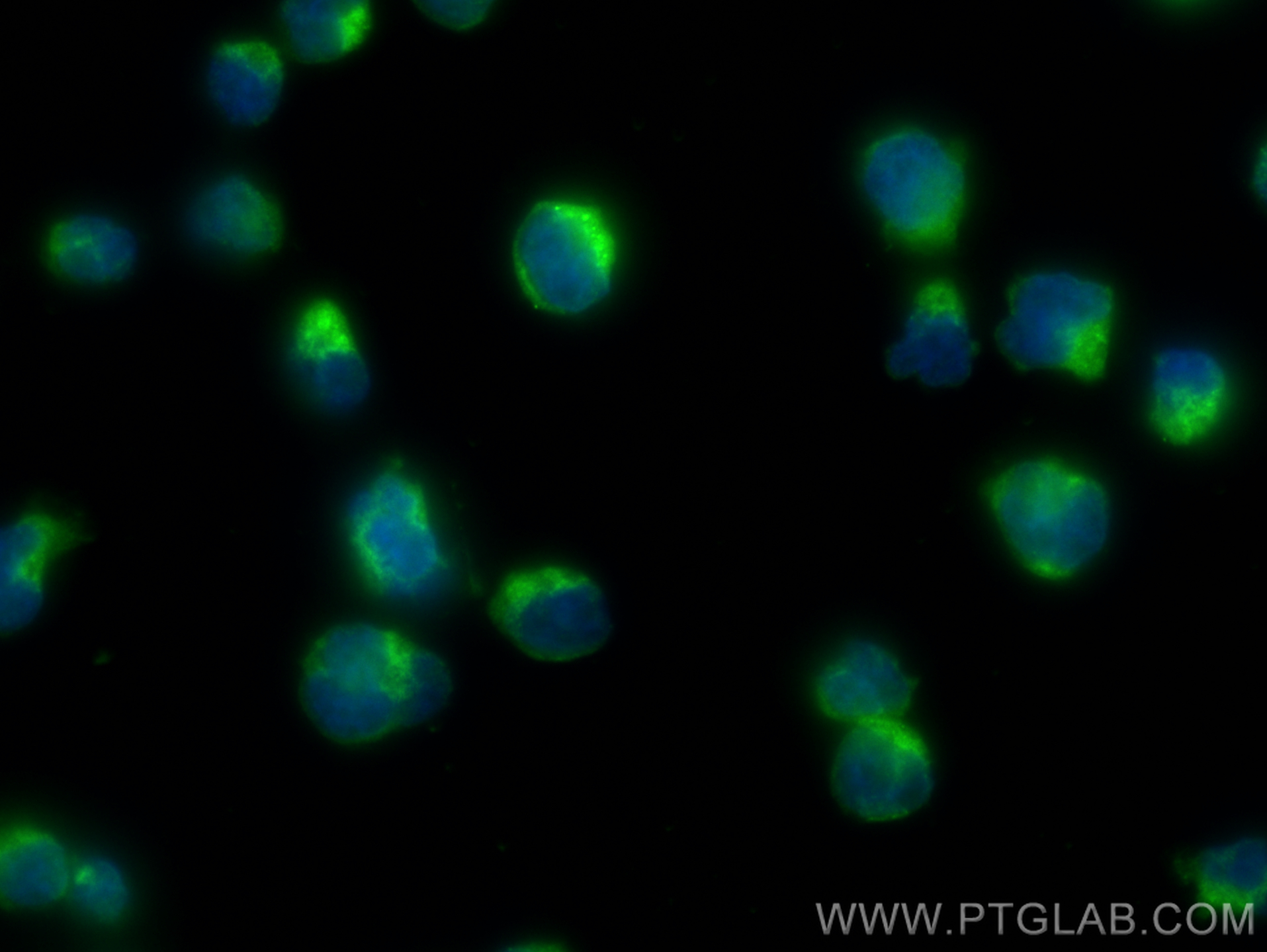 IF Staining of Jurkat using 20135-1-AP