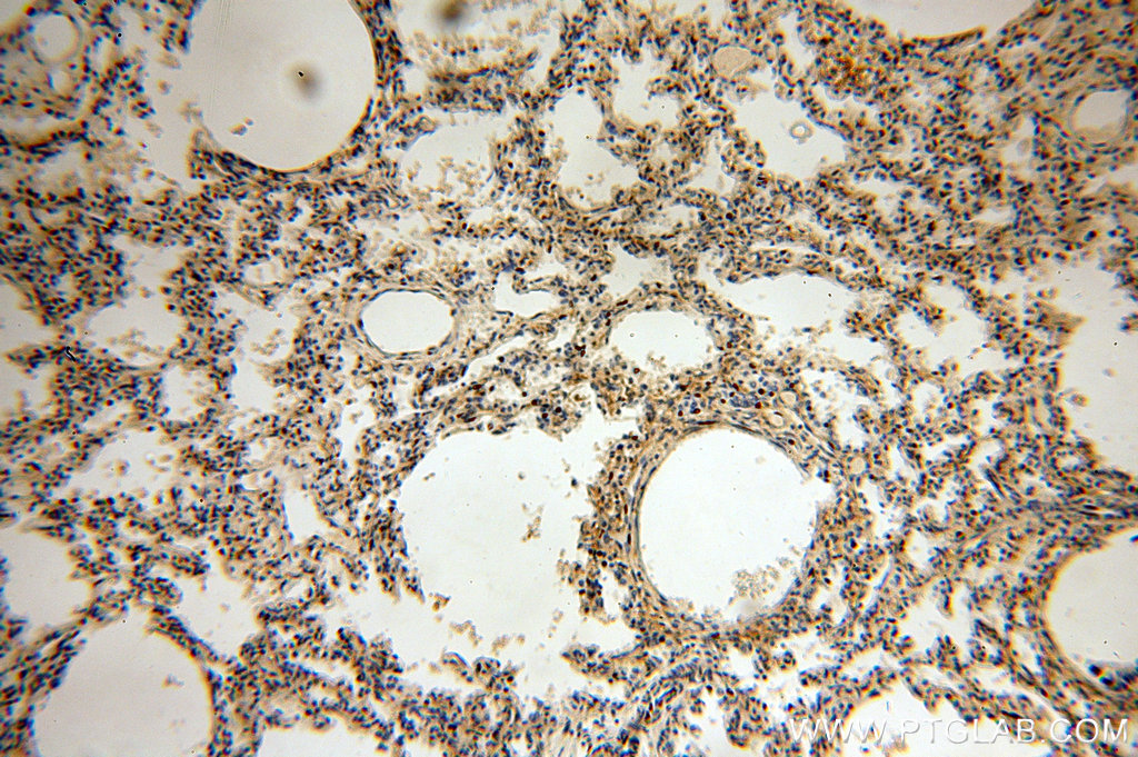 IHC staining of human lung using 20135-1-AP