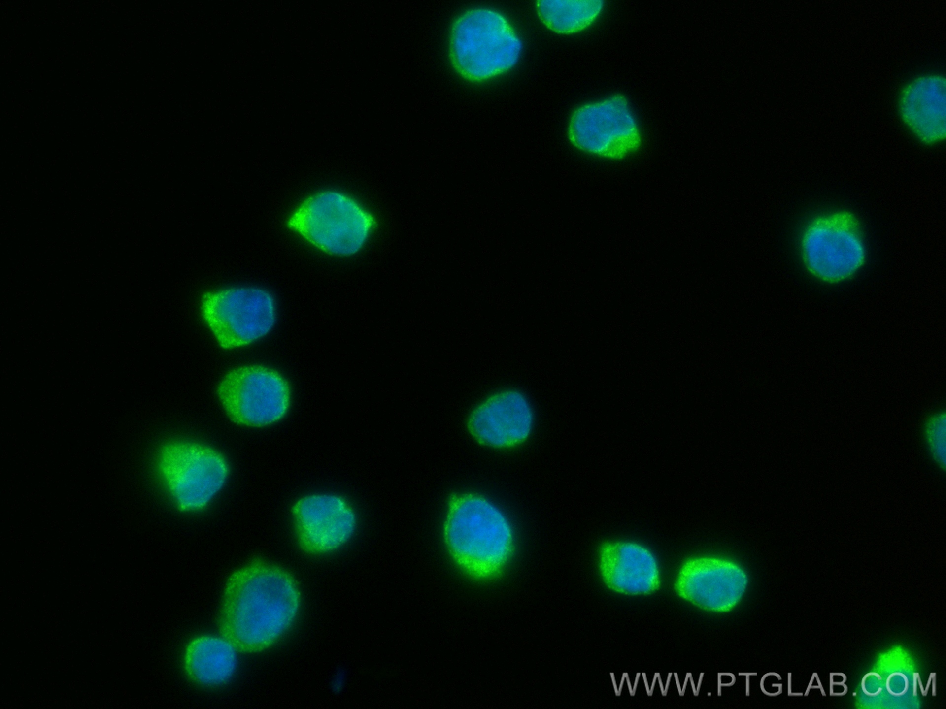 IF Staining of Jurkat using 82967-1-RR (same clone as 82967-1-PBS)