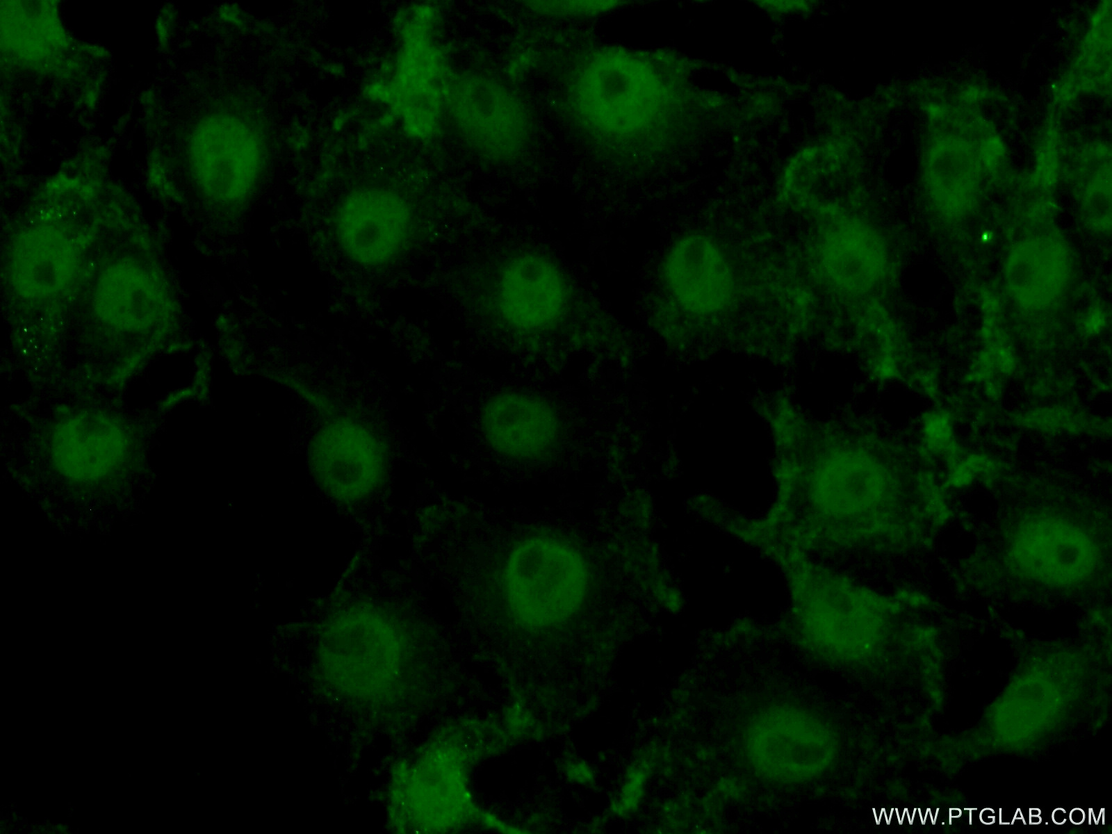 IF Staining of SH-SY5Y using 17570-1-AP
