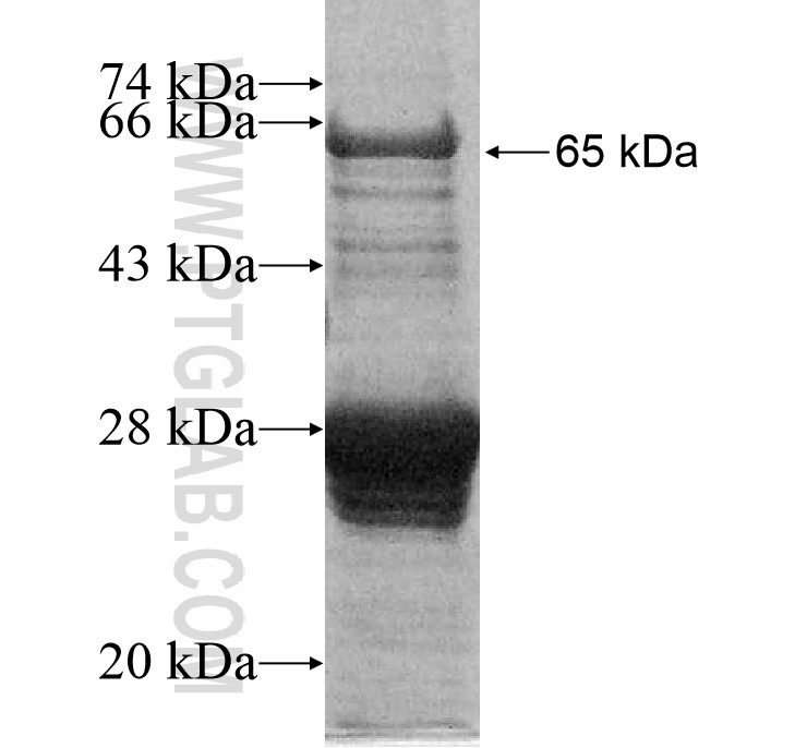 ACAP3 fusion protein Ag11777 SDS-PAGE