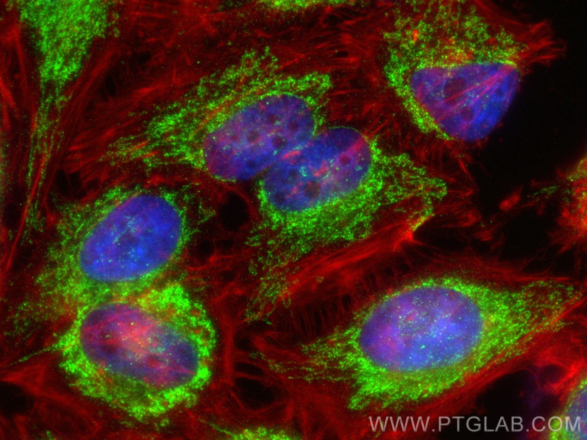 IF Staining of HeLa using 16215-1-AP