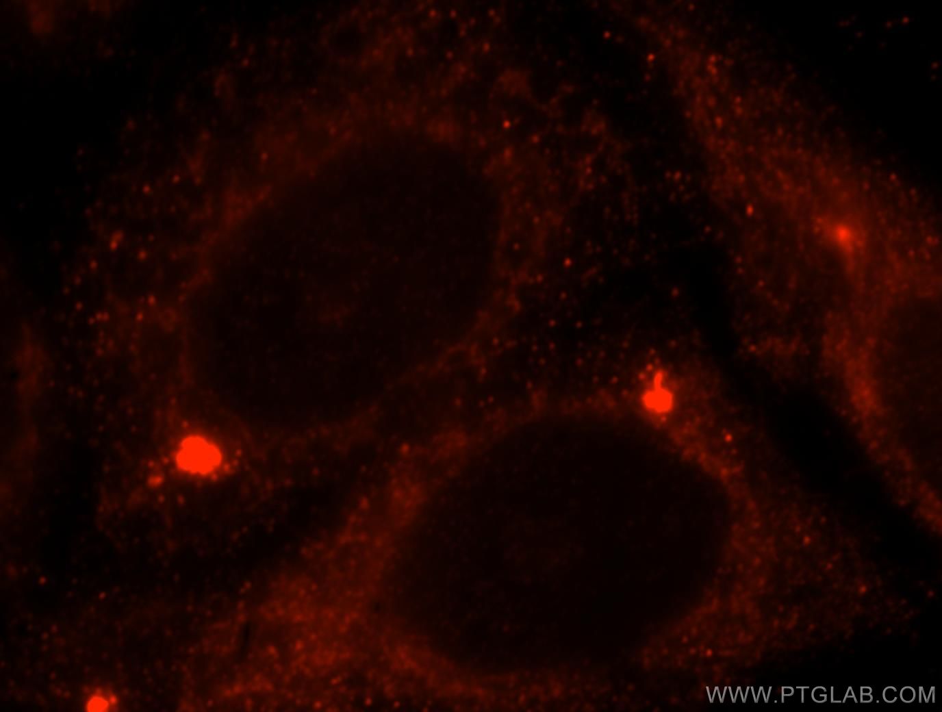 IF Staining of HeLa using 16215-1-AP