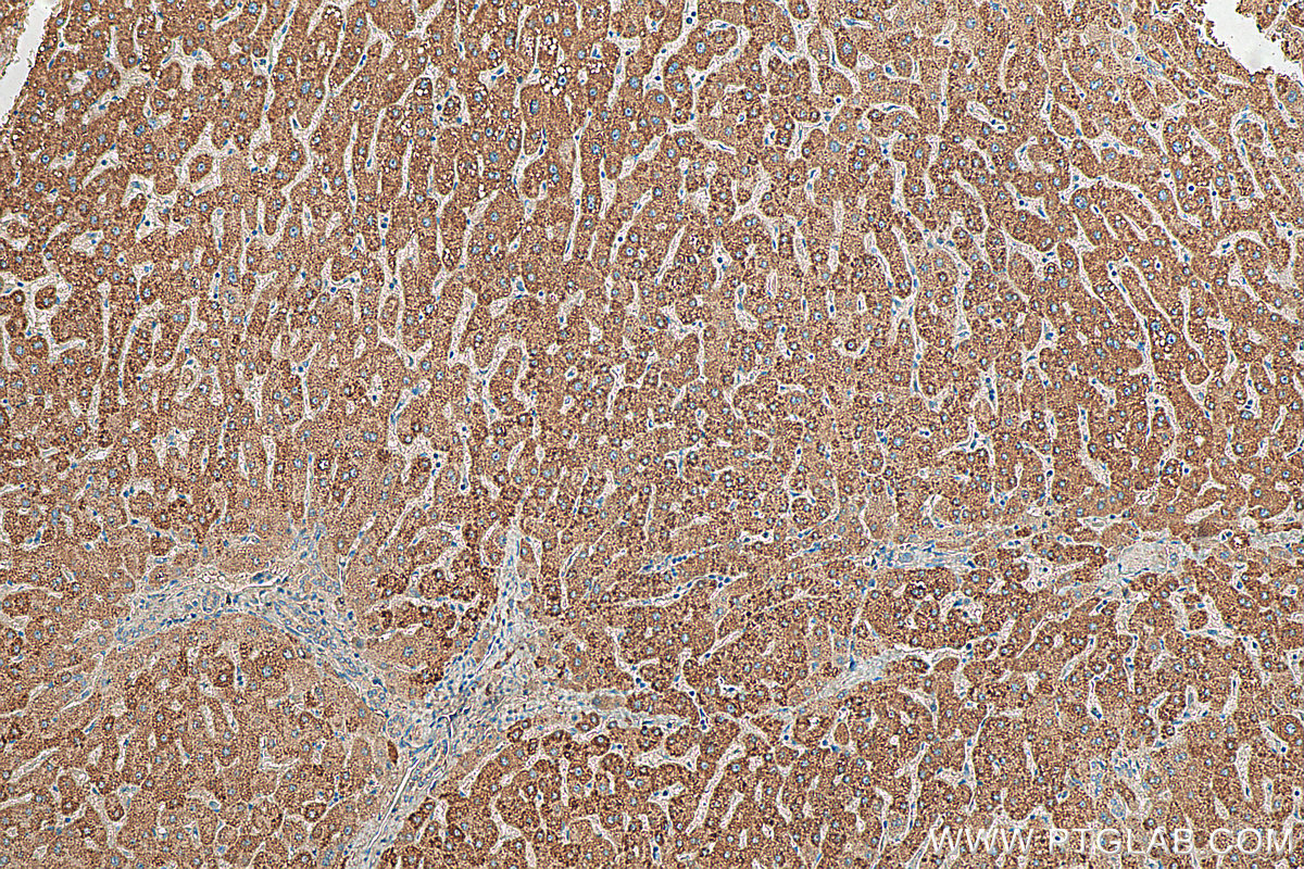 IHC staining of human liver using 16215-1-AP