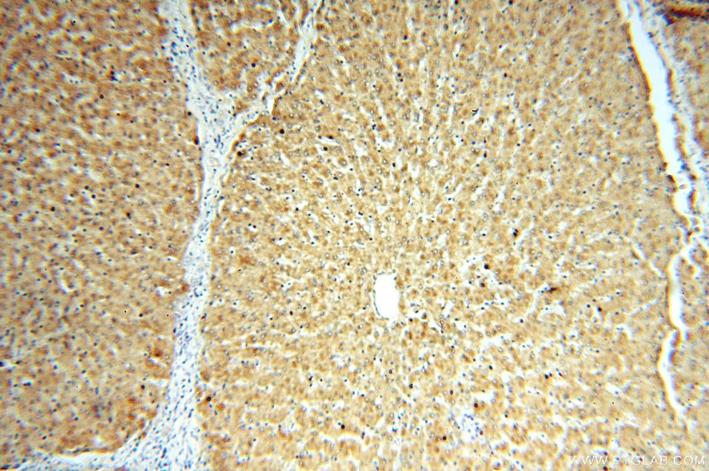 IHC staining of human liver using 14755-1-AP