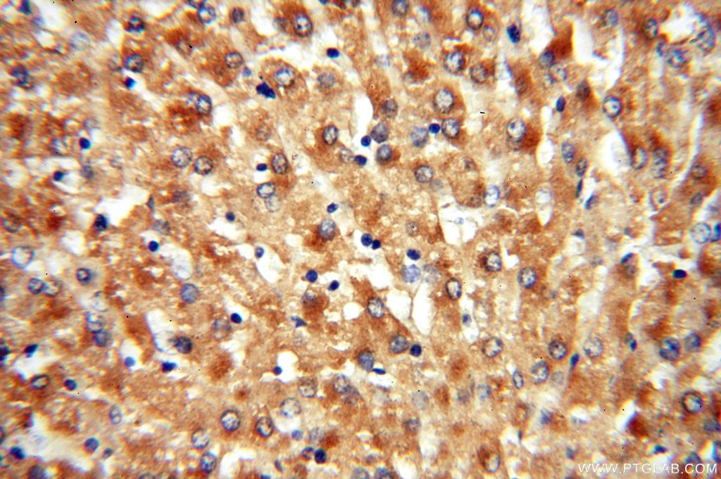 ACAT2 Polyclonal antibody