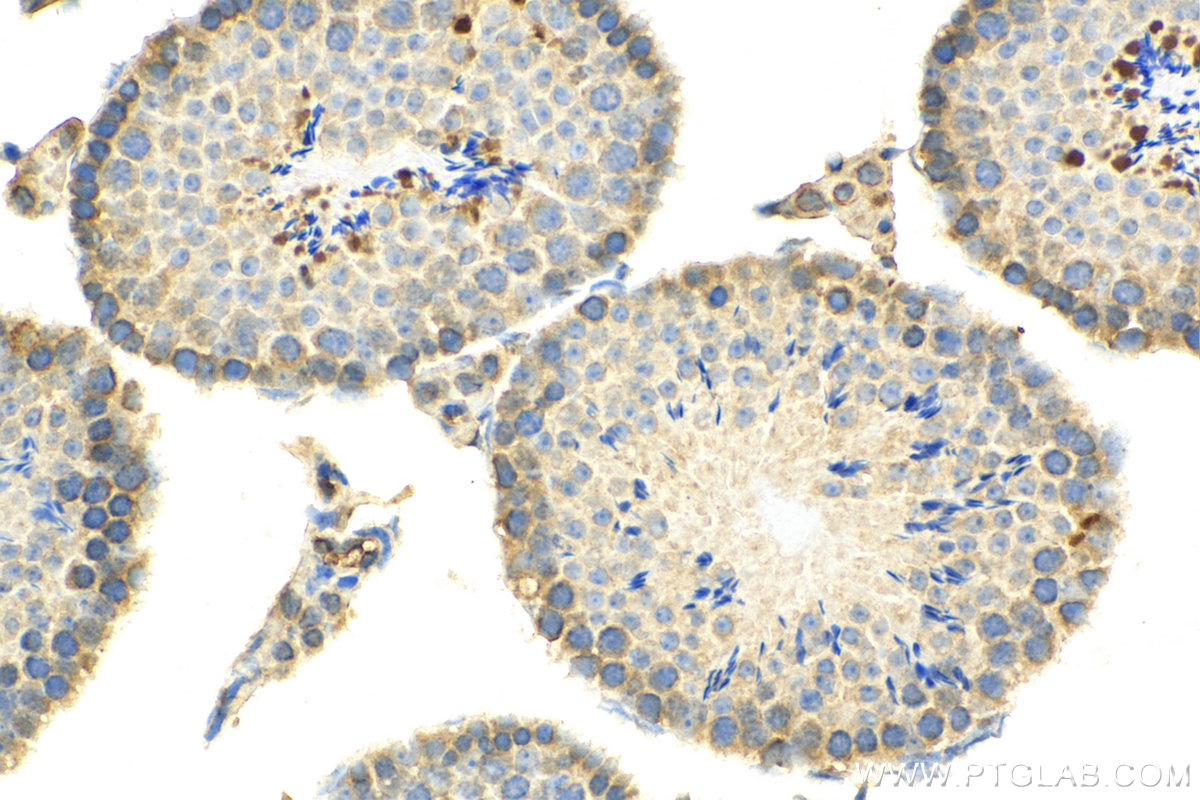 IHC staining of mouse testis using 14096-1-AP