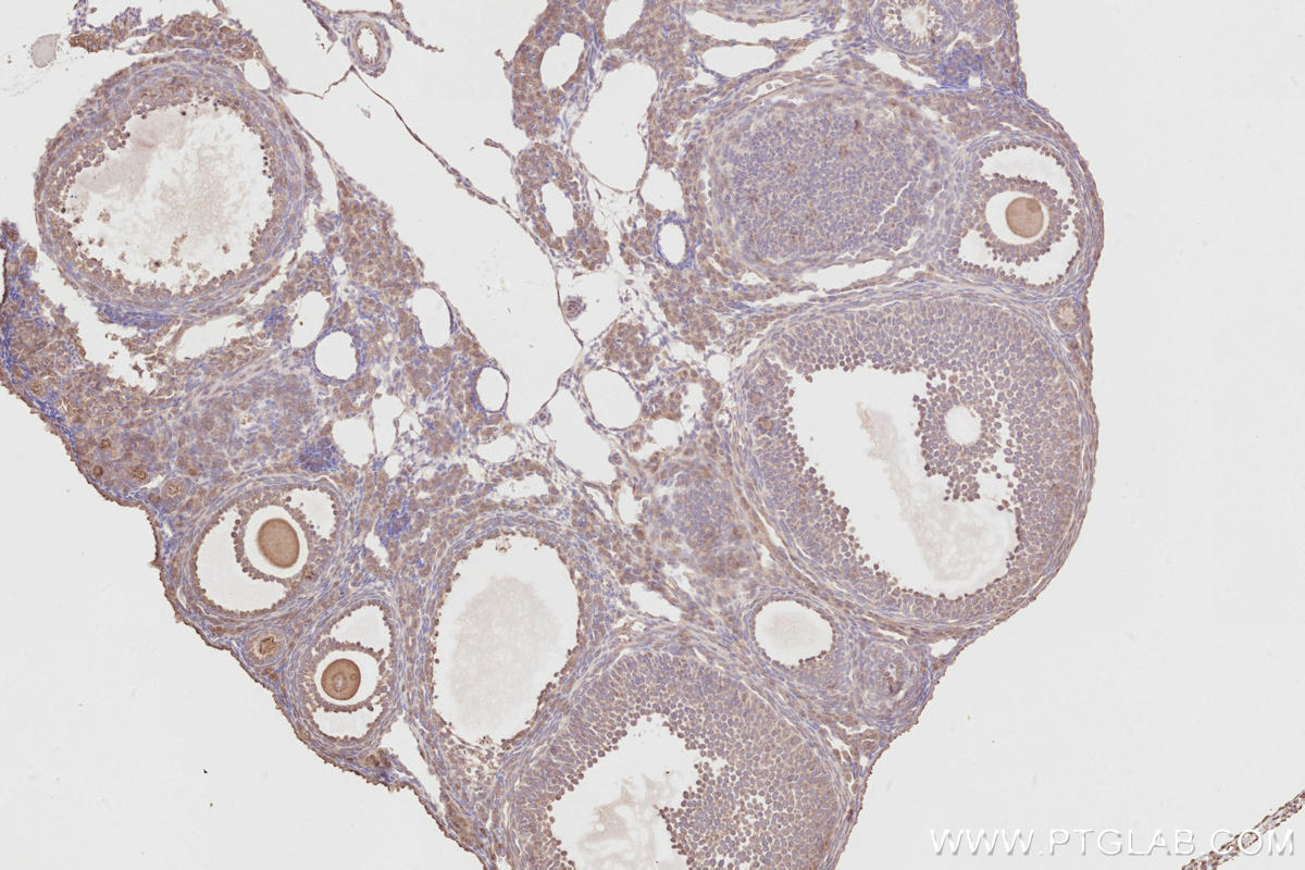 IHC staining of mouse ovary using 14096-1-AP