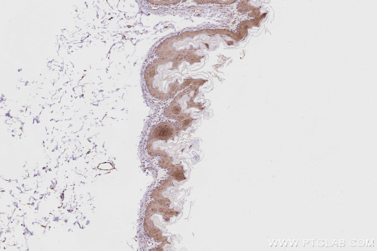 IHC staining of mouse stomach using 14096-1-AP