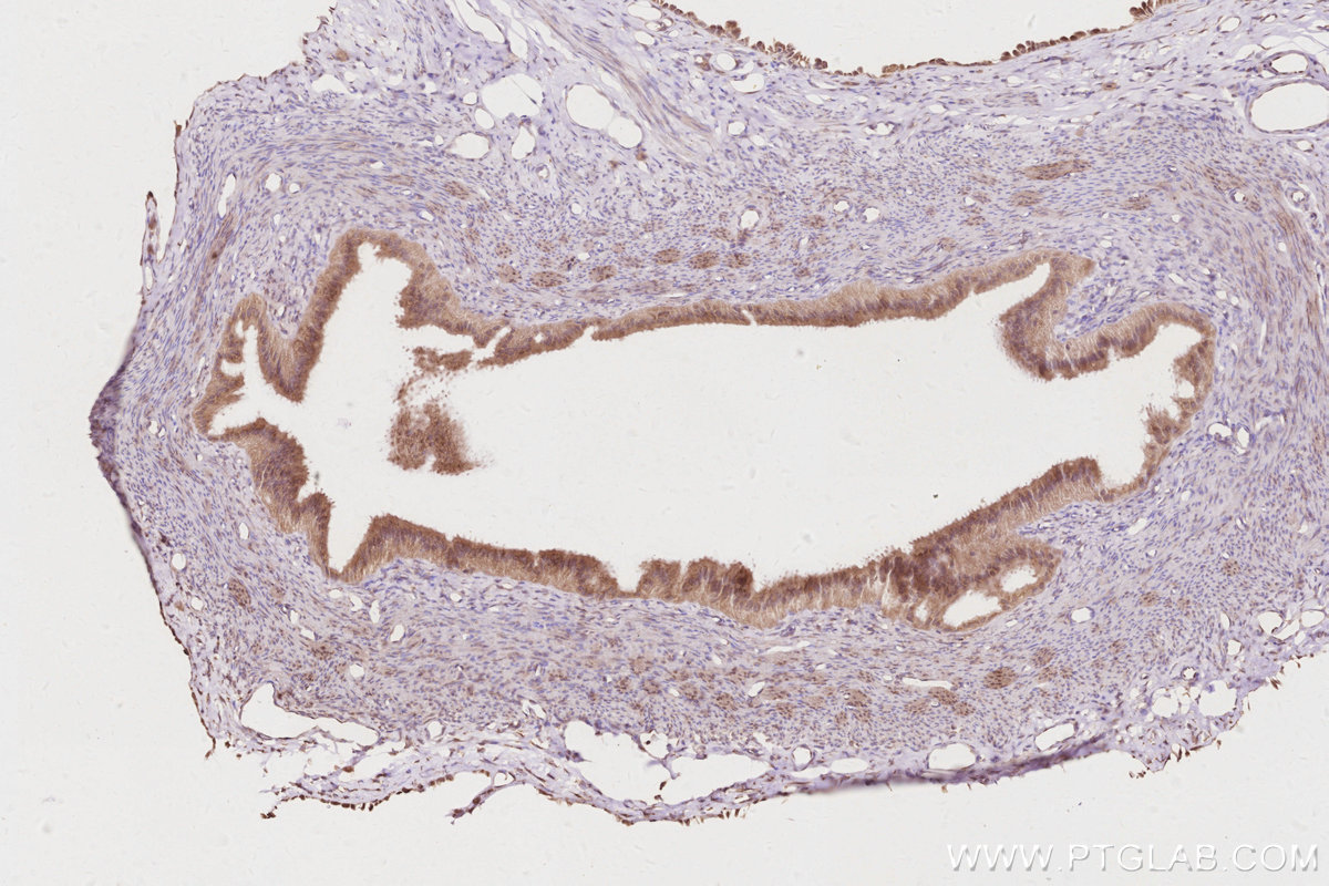 IHC staining of rat ovary using 14096-1-AP