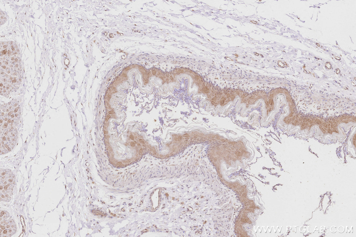 IHC staining of rat stomach using 14096-1-AP