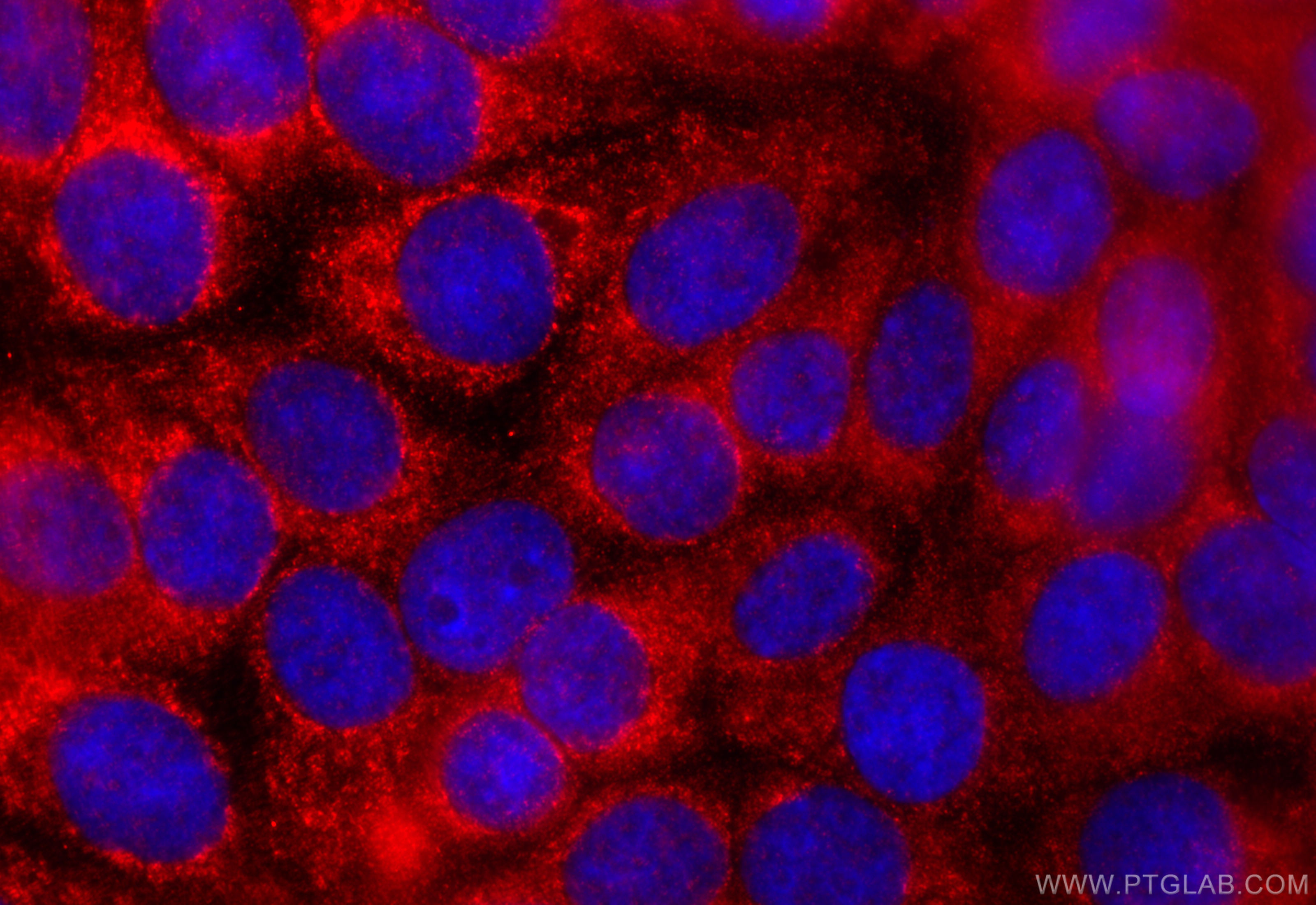 IF Staining of MCF-7 using 20941-1-AP