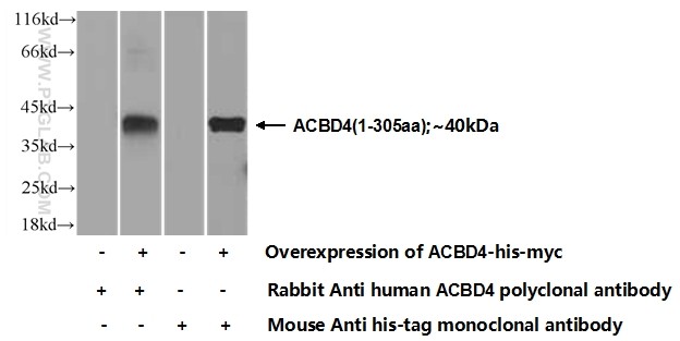 ACBD4