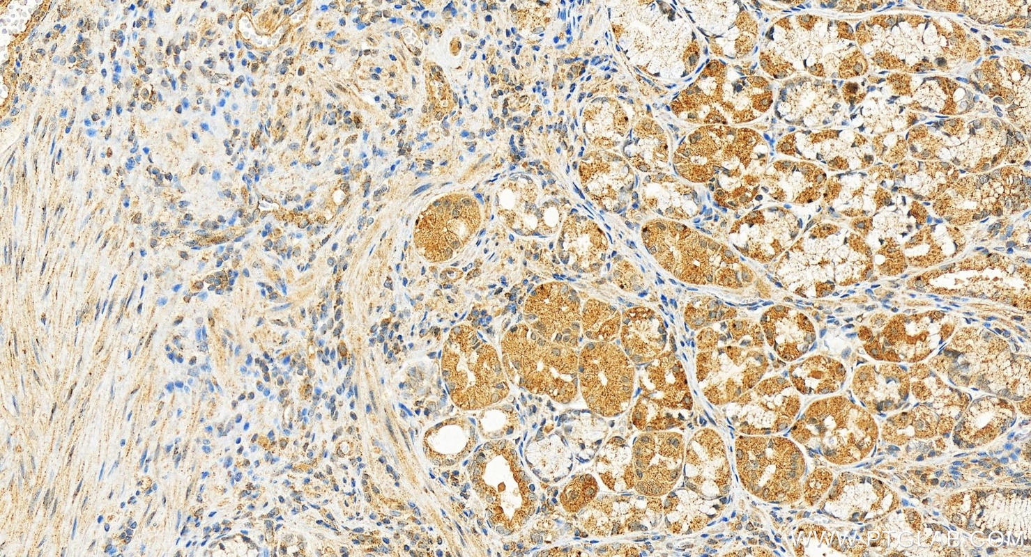 IHC staining of human stomach using 21080-1-AP