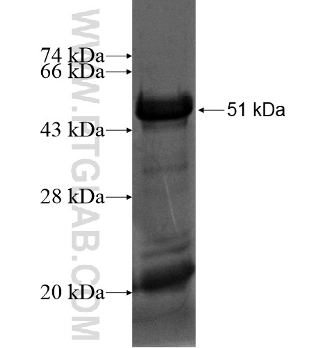 ACBD5 fusion protein Ag15511 SDS-PAGE ACBD5 fusion protein Ag15511 SDS-PAGE