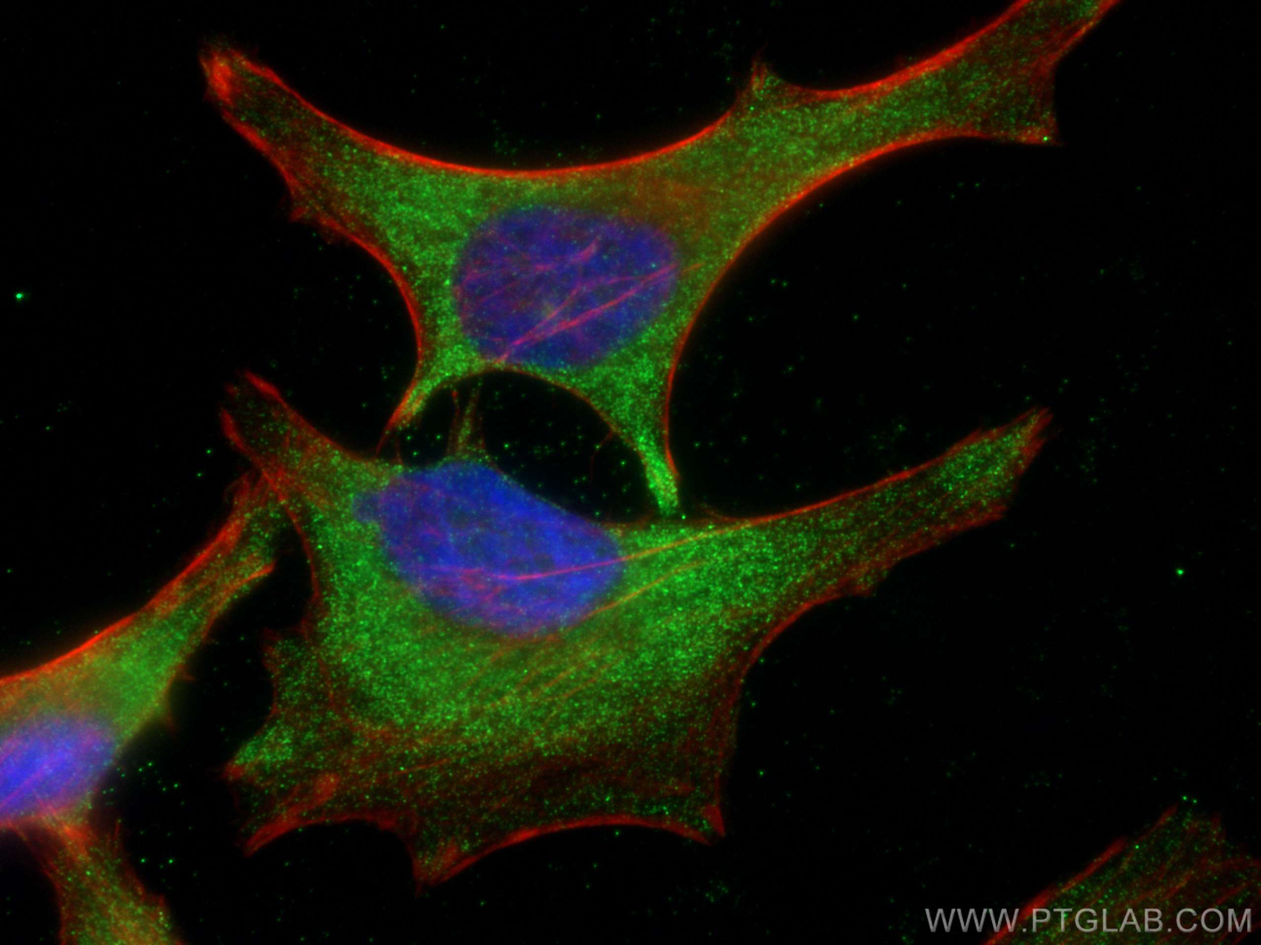 IF Staining of HeLa using 67373-1-Ig