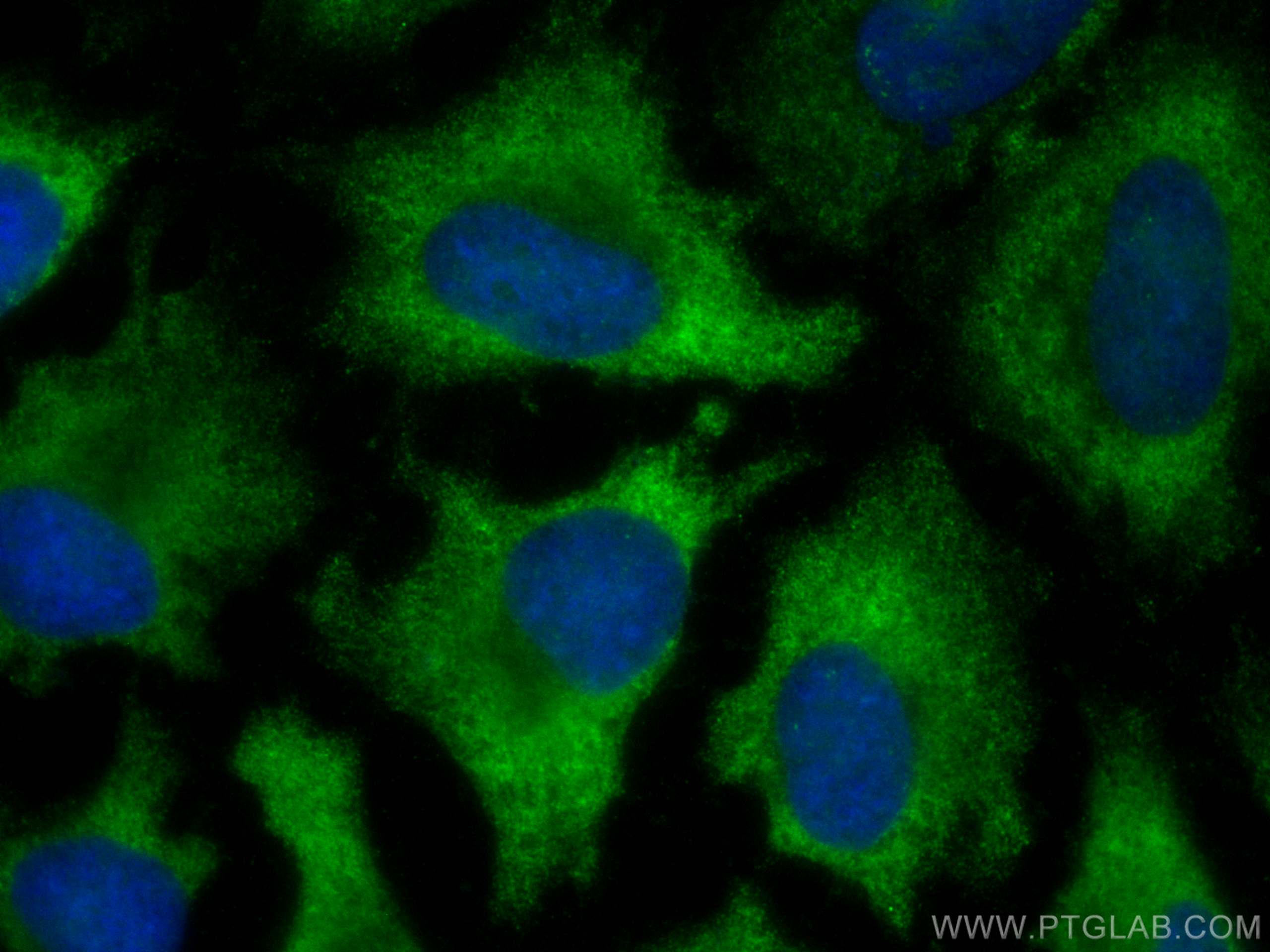 IF Staining of HeLa using CL488-67373