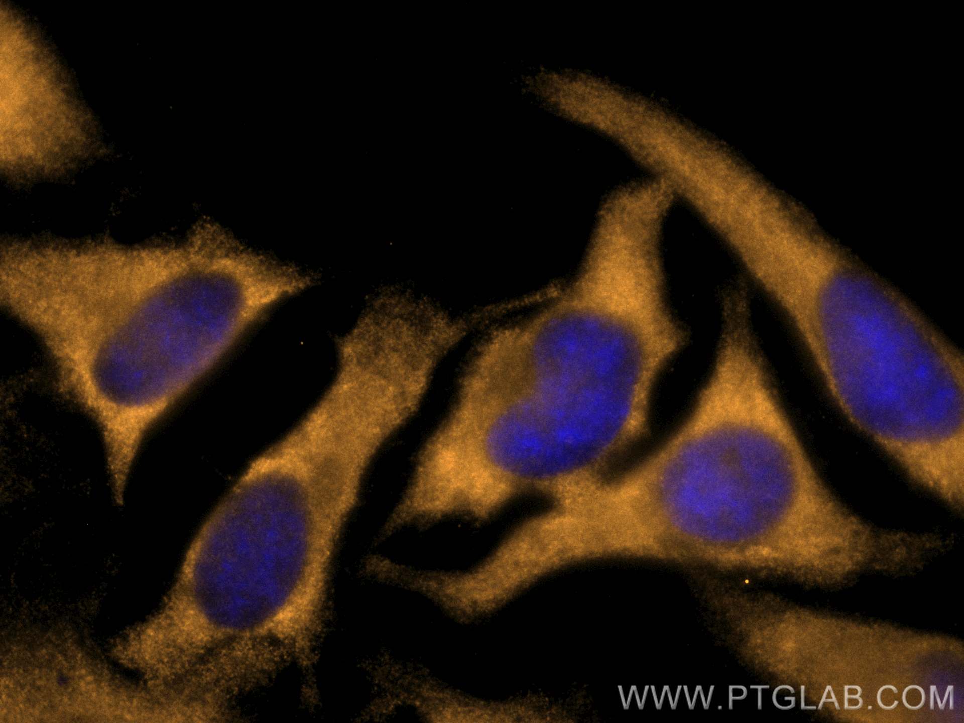 IF Staining of HeLa using CL555-67373