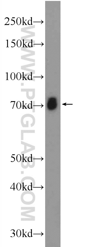 WB analysis of rat brain using 17851-1-AP